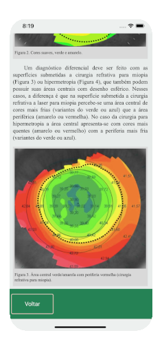 Imagem da tela do aplicativo TopEye